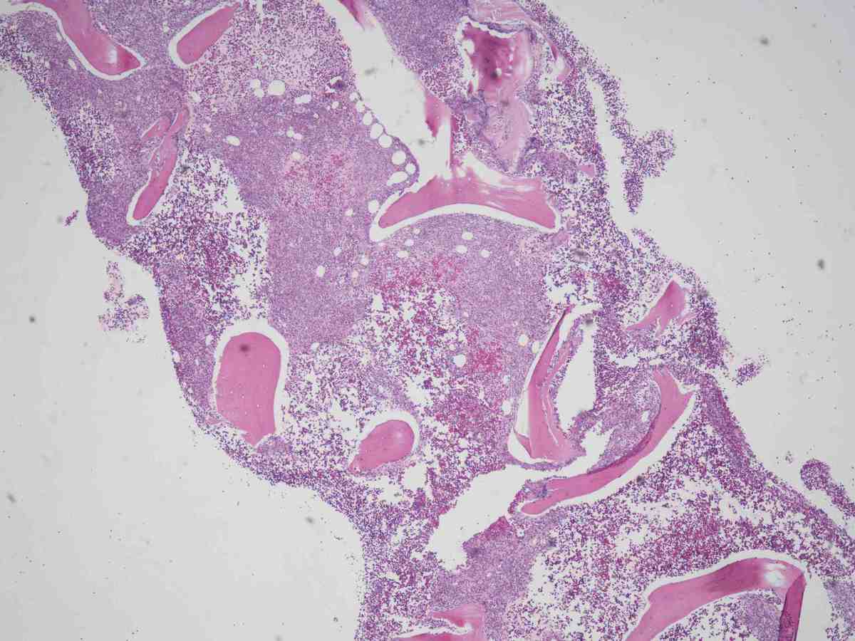 Bone Marrow HE 4X